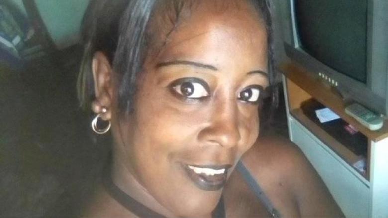 La cubana Triana Ferrer, víctima de un intento de feminicidio.